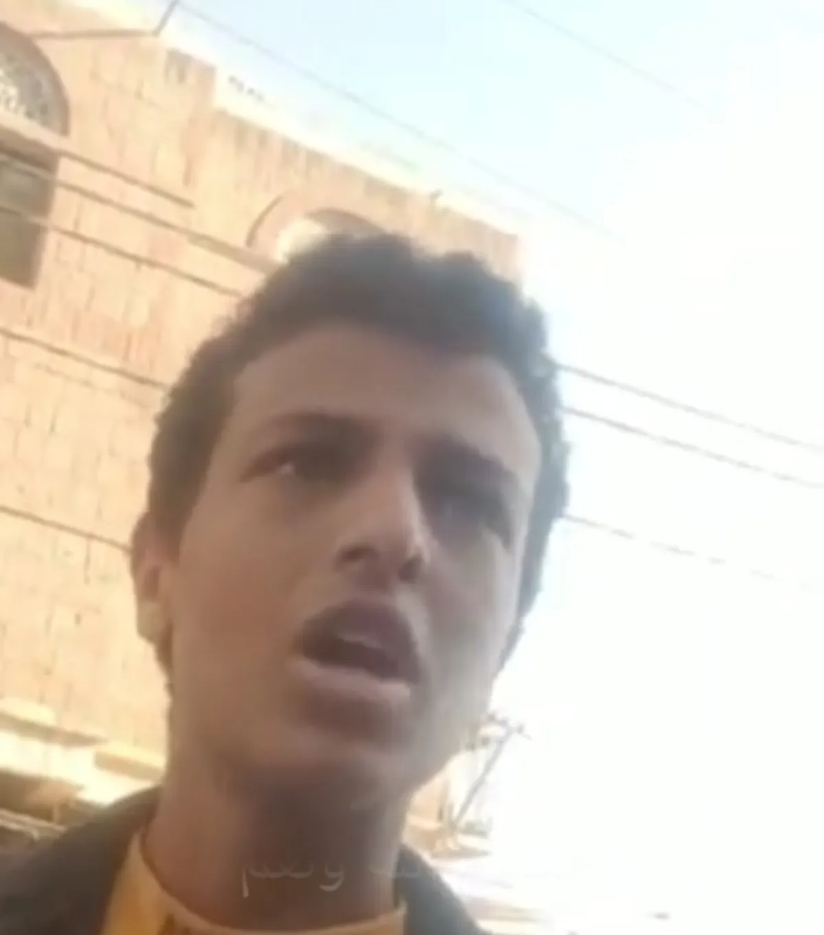 تعز .. عامل نظافة في التربة يعتدي على طفل بالضرب بسبب رفضه دفع إتاوات على بسطته