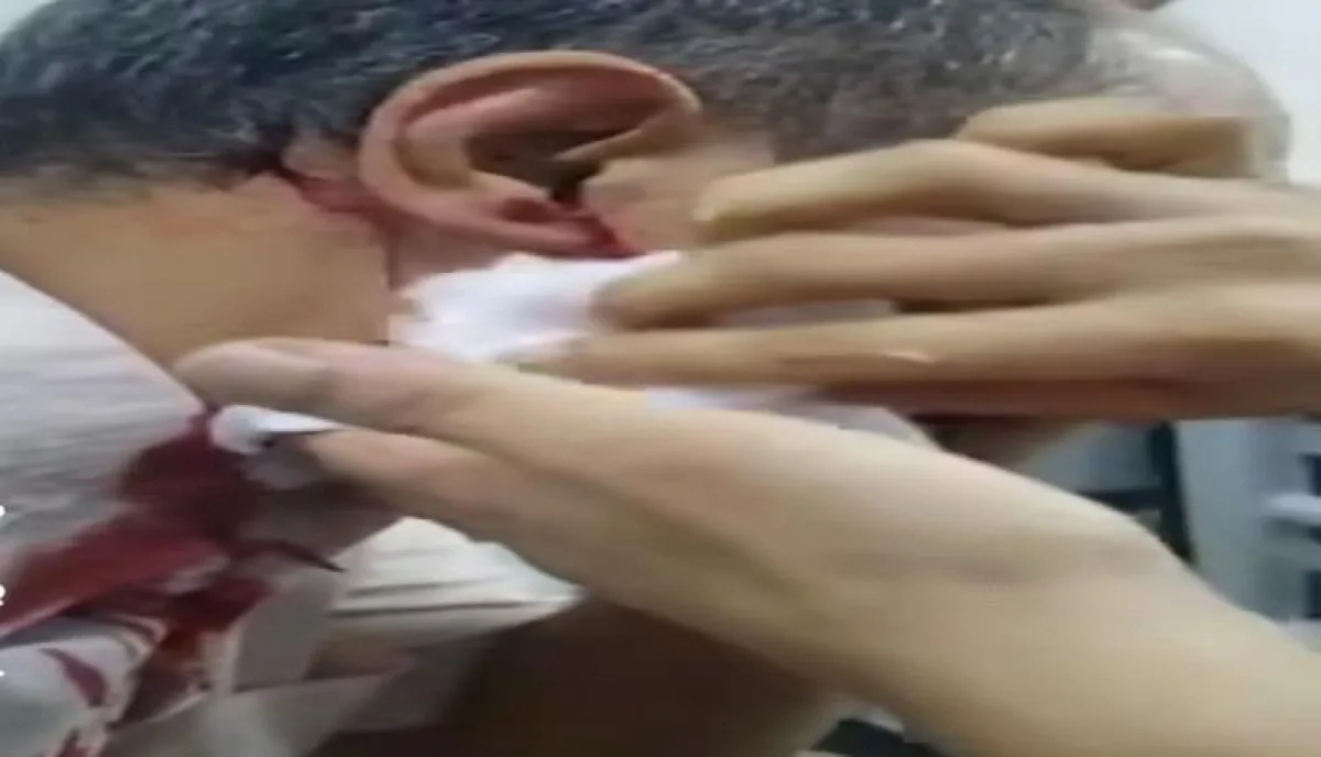 الحديدة .. إمام مسجد الدهمية يطعن جاره بسبب التعبئة الحوثية الخاطئة