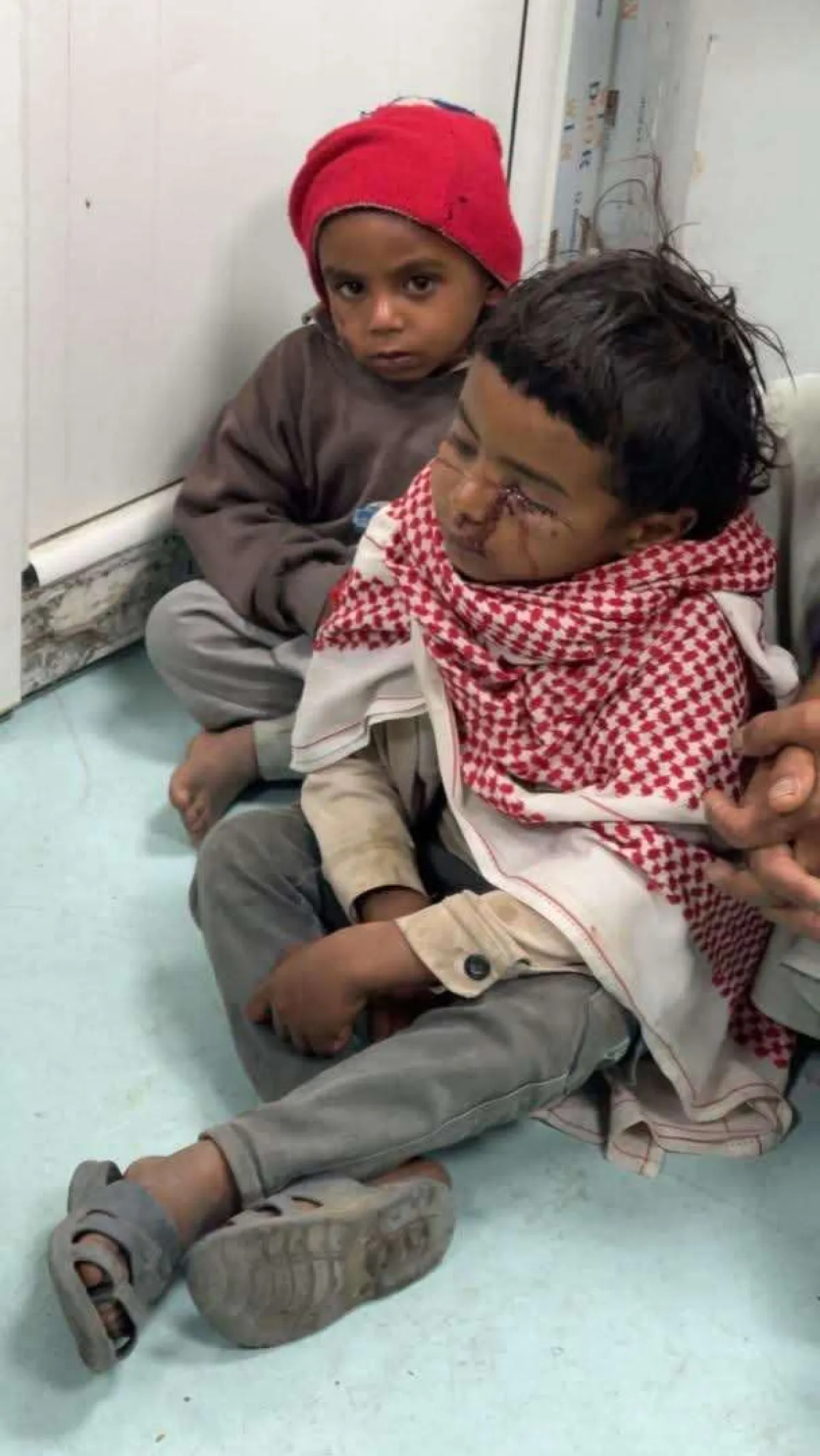 إهمال حوثي يهدد أرواح الأطفال في صنعاء… كلاب ضالة تهاجم طفلين وسط غياب تام للسلطات