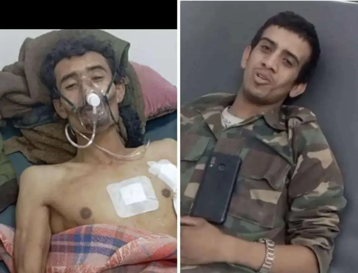 إصابة جنديين من اللواء الثامن دفاع شبوة إثر قصف حوثي استهدف مواقع التماس