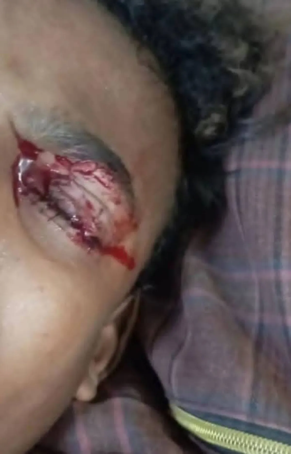 أطفال يقضون إجازة العيد بطوارئ المستشفيات