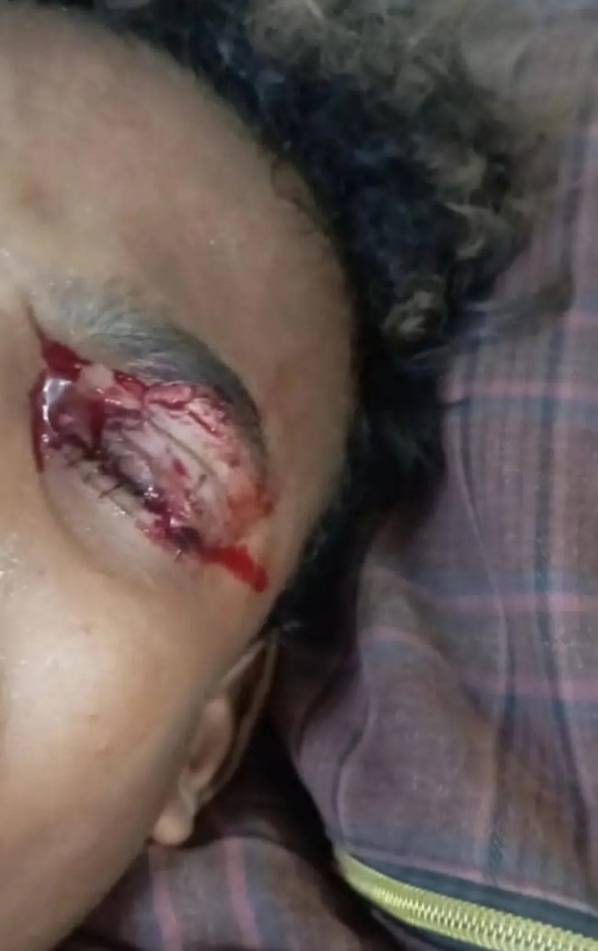 في عدة محافظات يمنية .. إصابات بين الأطفال بسبب الألعاب النارية ومسدسات الخرز