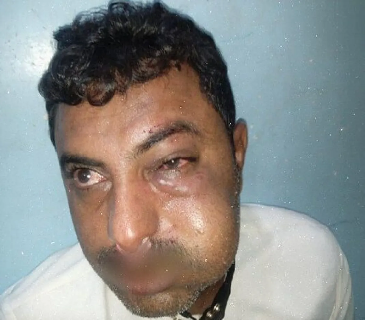 اعتداء قيادي حوثي على محامٍ في الحديدة يثير استياءً واسعاً