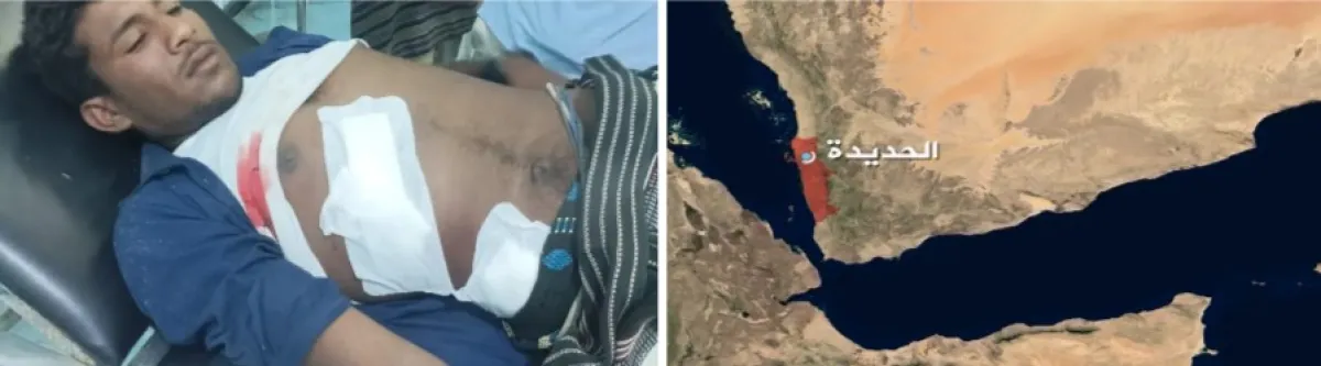 إصابة نازح بقصف حوثي طال مخيم الحيمة جنوبي الحديدة