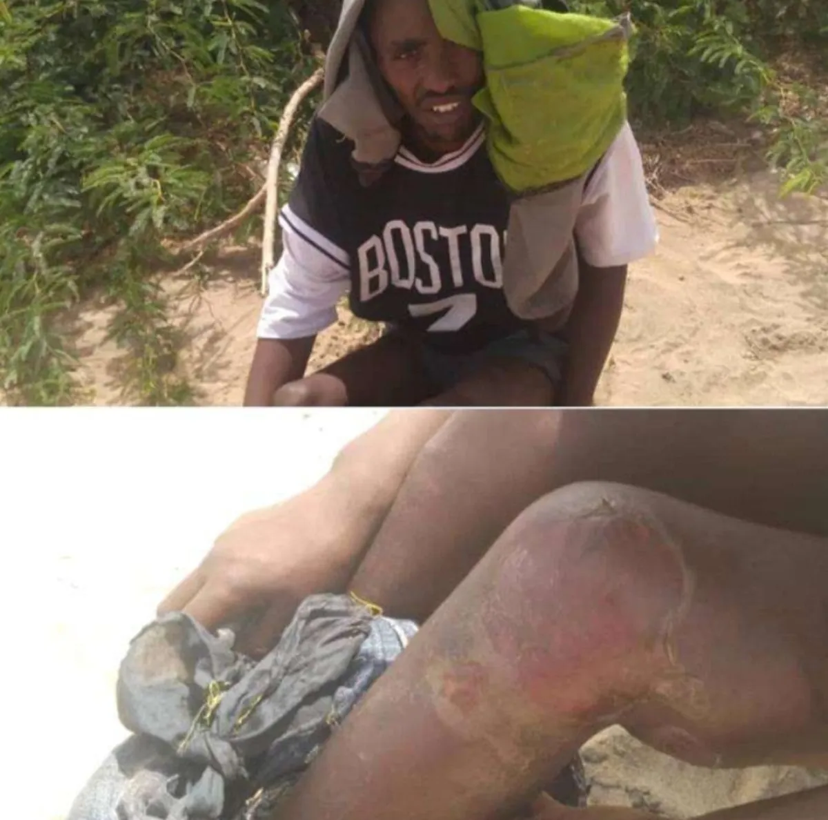 أبين.. اعتداءات وابتزاز بحق المهاجرين في أحور