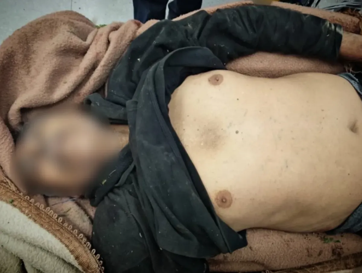 استشهاد مسن برصاص قناص حوثي في حي الزهراء بتعز