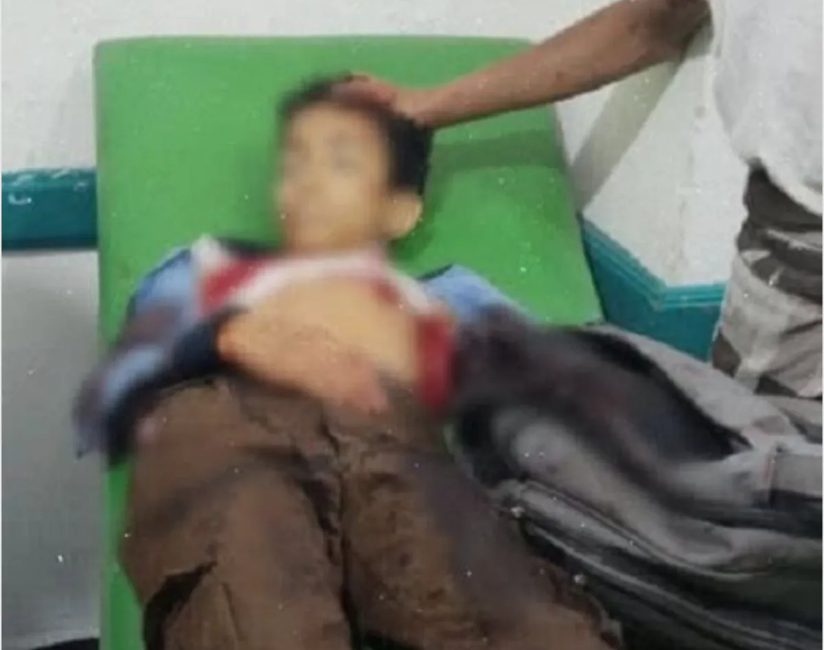 المركز الأمريكي للعدالة: مليشيا الحوثي تستخدم القنص لإفراغ أحياء تعز