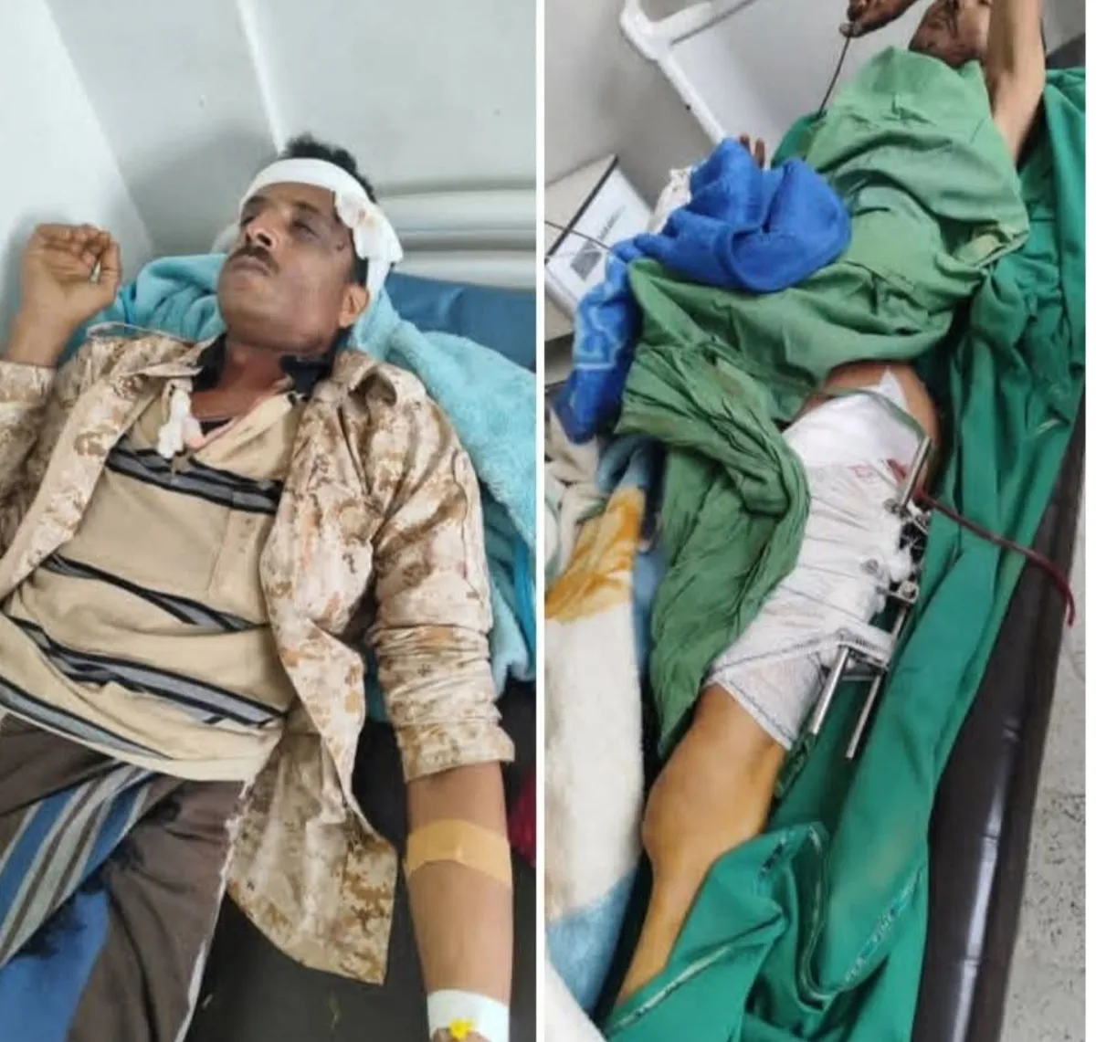 استشهاد جنديين في جبهتي يافع وتعز وإحباط هجوم حوثي