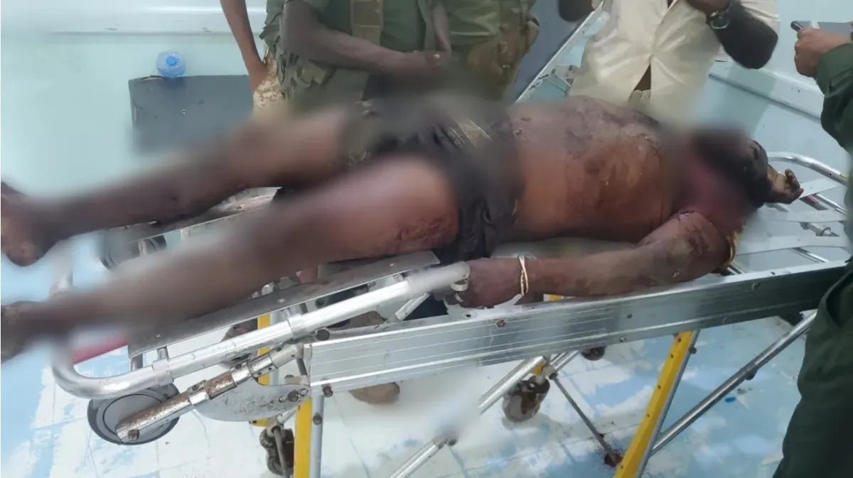 وفاة مواطن متأثرًا بإصابة ناجمة عن انفجار مقذوف حوثي في الخوخة