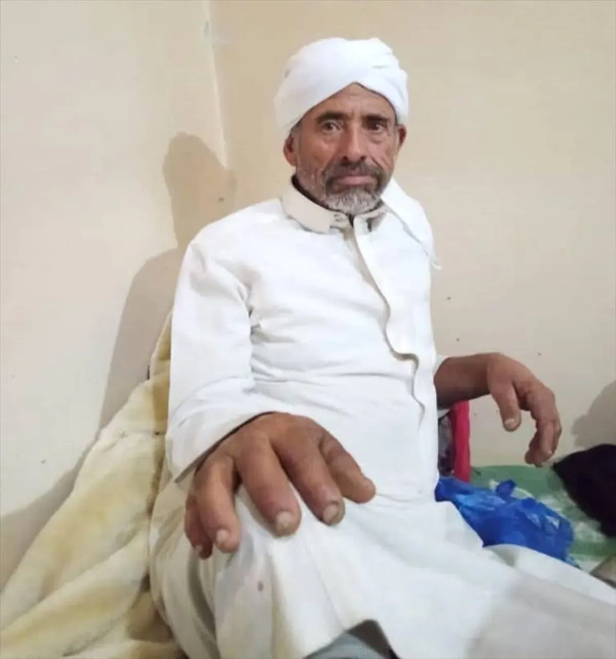 اعتداء وحشي في تعز يُدخل مواطناً في غيبوبة ويثير استياءً شعبياً