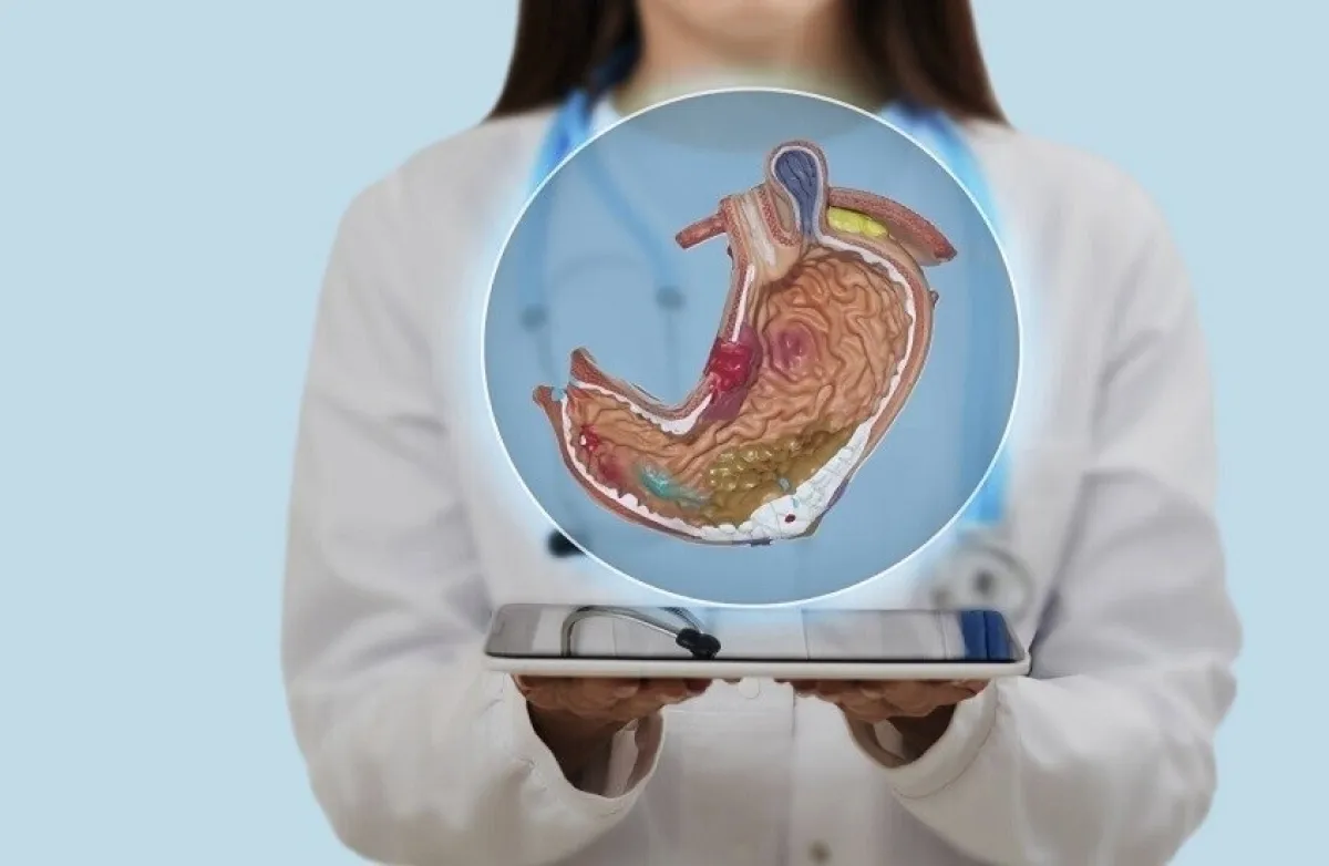 أطعمة تزيد خطر قرحة المعدة.. تعرف عليها