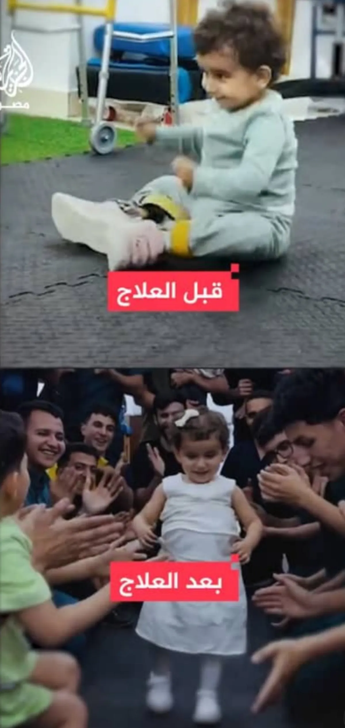 فريق طبي مصري يحتفي بشفاء طفلة يمنية من شلل في الأطراف السفلية