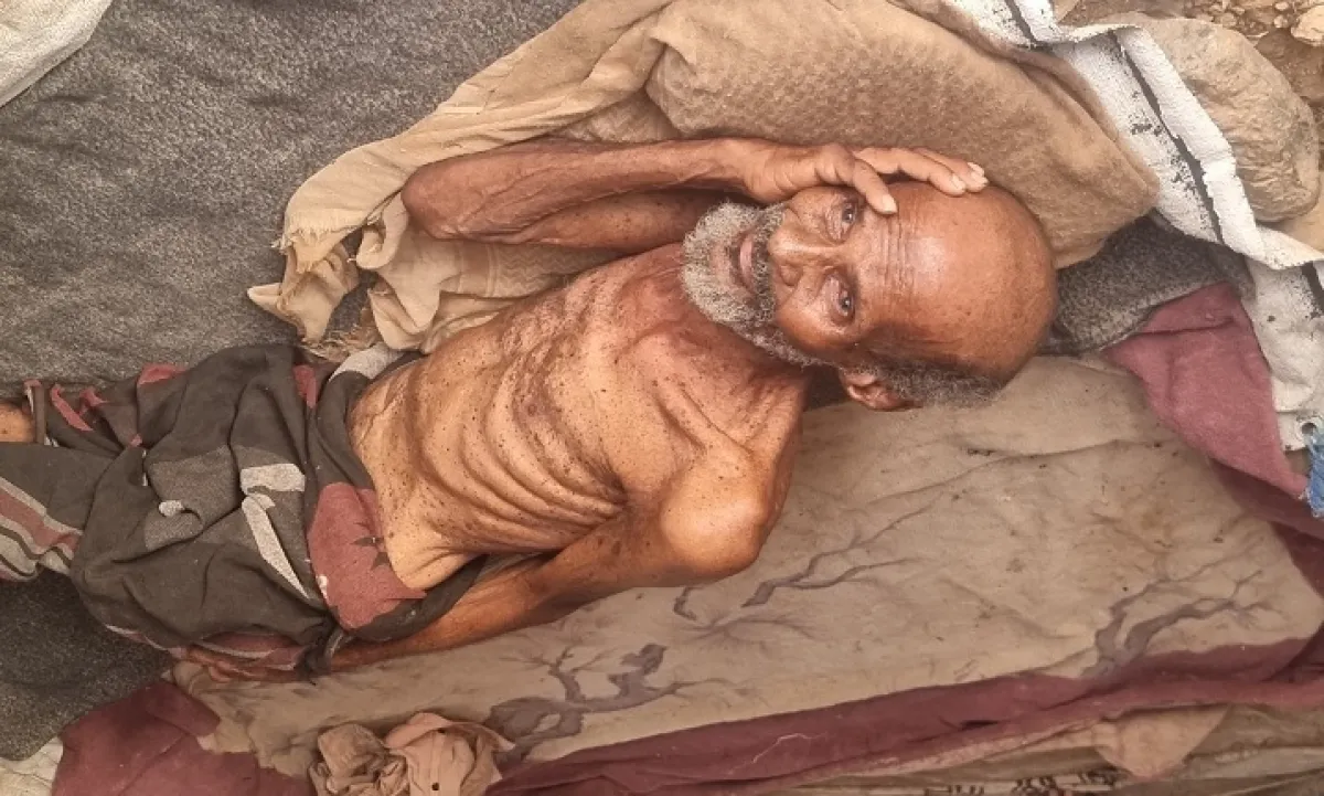 وفاة نازح مُسن جوعاً في حجة وسط اتهامات لمليشيا الحوثي بتقويض العمل الإغاثي