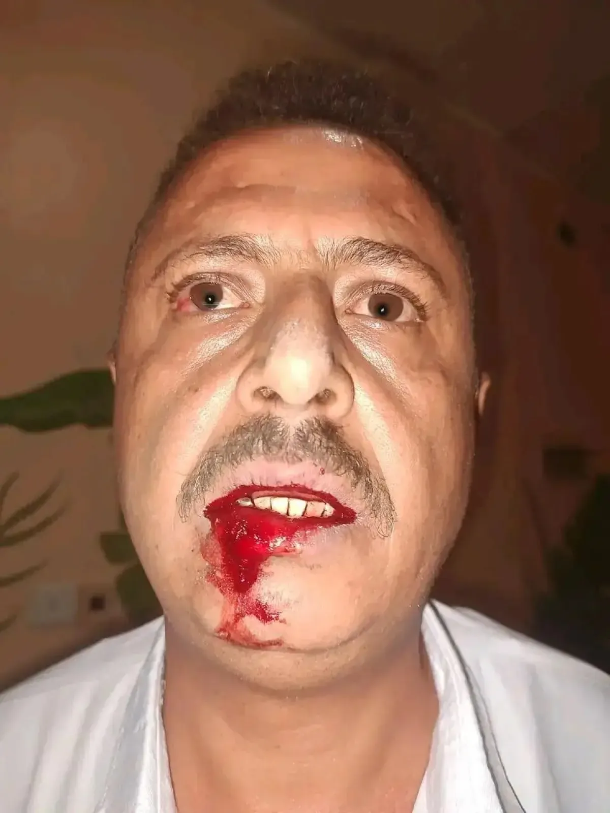 سببت له اصابات بليغة :  محاولة دهس مواطن بسيارة مجهولة وسط مدينة  تعز