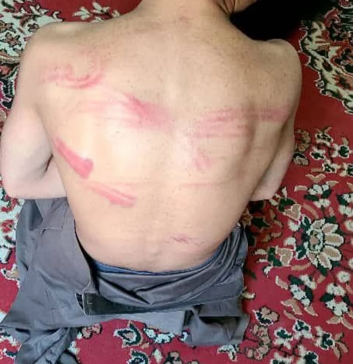 تعذيب طفل حتى الموت النفسي.. الحوثيون يحولون سجون صعدة إلى مسالخ بشرية خارج القانون