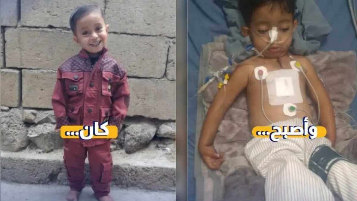 3 سنوات طريح الفراش.. خطأ طبي بالجمهوري يشلّ حركة الطفل "قيس الكناني" وأسرته تناشد معالجته بالخارج