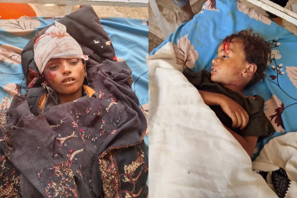 وفاة طفلين أثناء توجههما لاستلام مساعدات غذائية في تعز