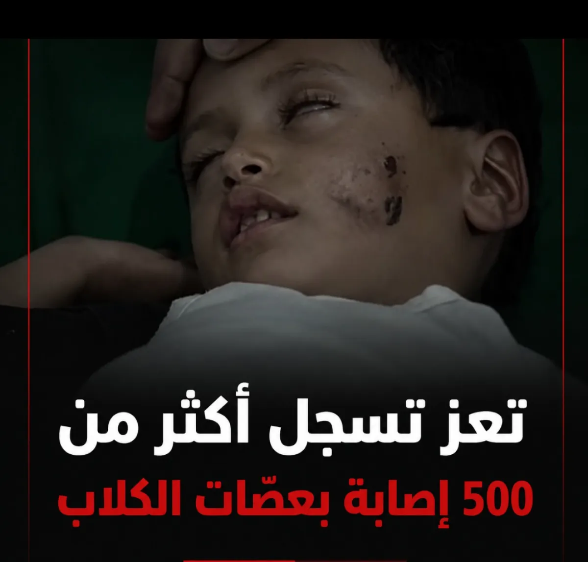 تعز تسجل أكثر من 500 إصابة بعضّات الكلاب