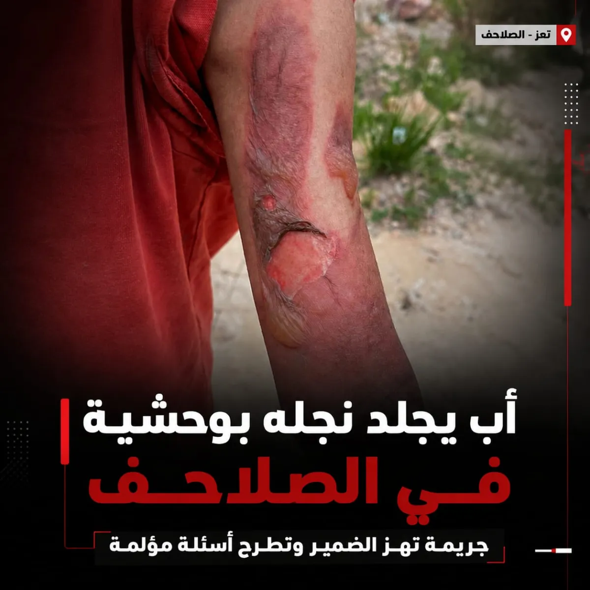أب يجلد نجله بوحشية في الصلاحف.. جريمة تهز الضمير وتطرح أسئلة مؤلمة