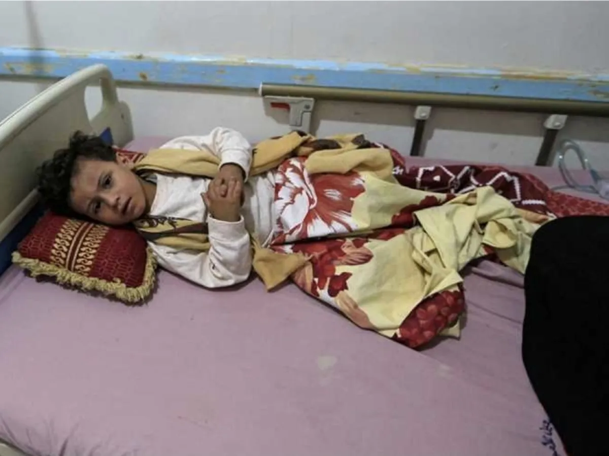 الحصبة تفتك بالأطفال: 16 ألف إصابة و93 وفاة في مناطق الحكومة اليمنية