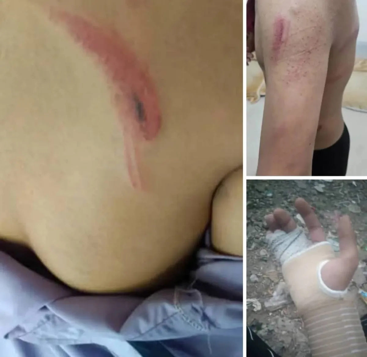 تعز.. مدير مدرسة أهلية حوثي يعتدي بصاعق كهربائي على طلابه بشكل وحشي بسبب الوتس أب