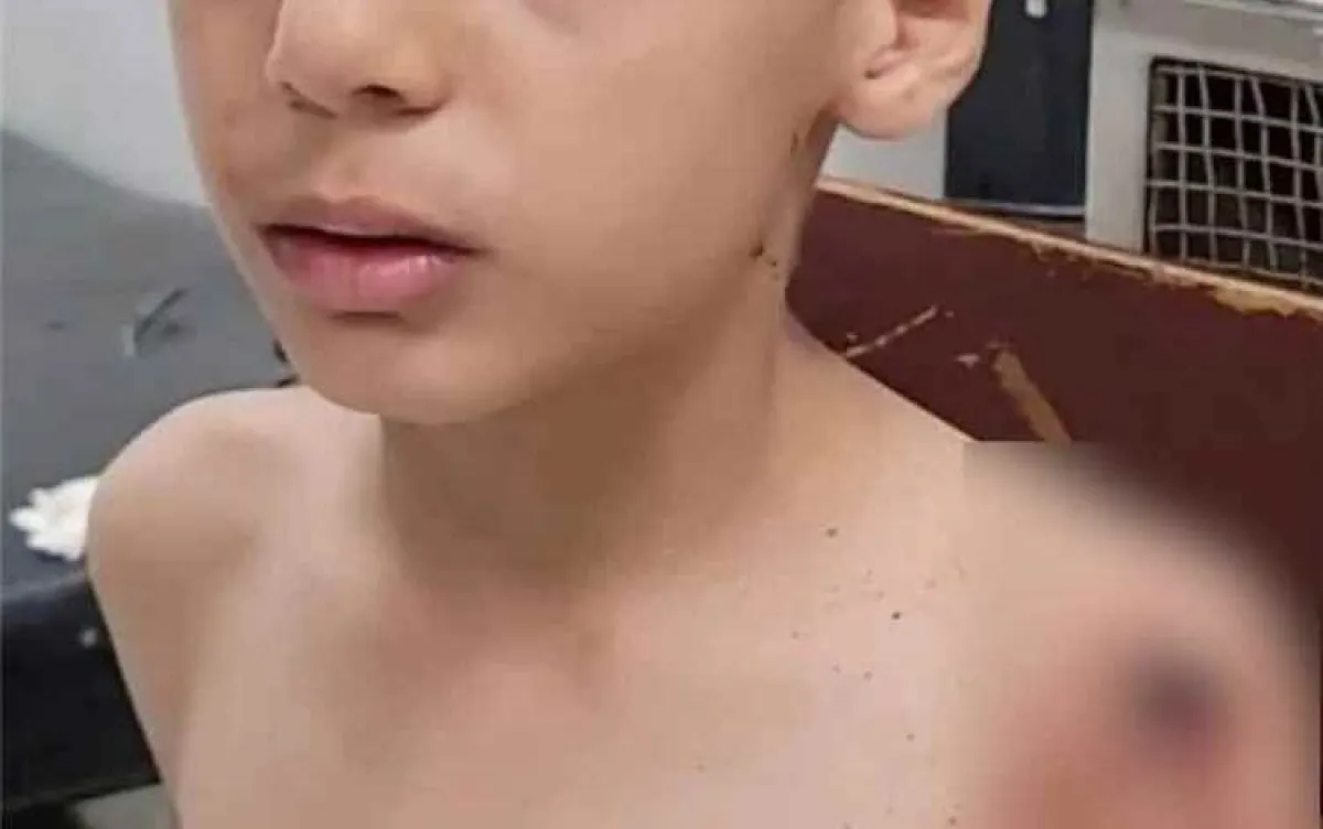 إصابة طفل بقصف حوثي على حي سكني في تعز