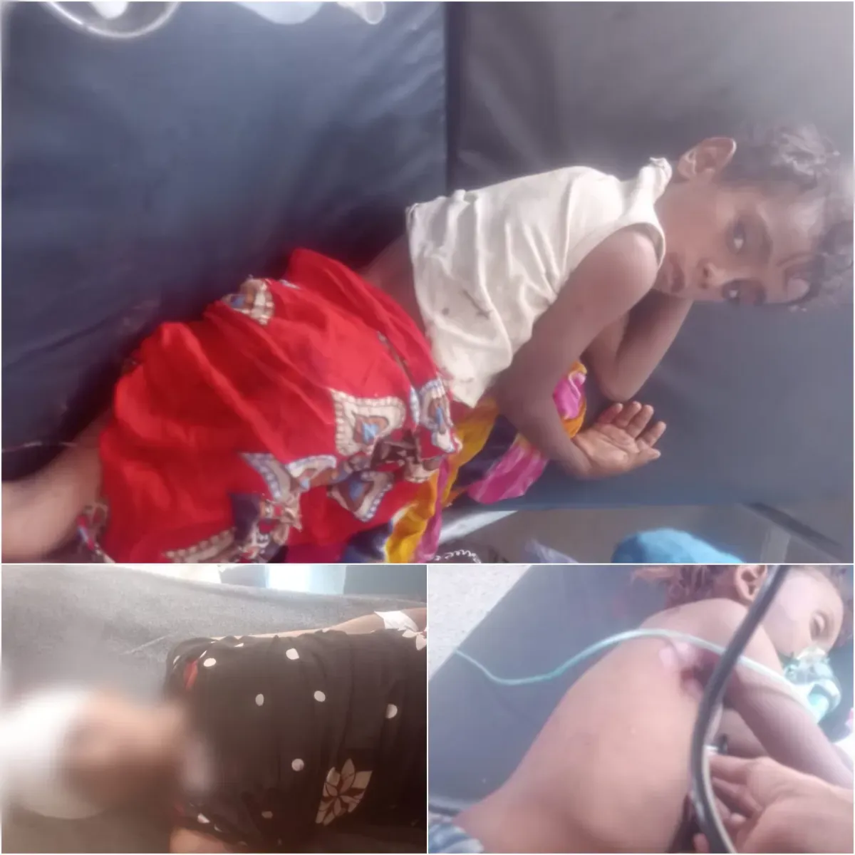 قصف حوثي يستهدف قرى حيس ويوقع قتلى وجرحى مدنيين.. الأطفال في مرمى انتقام المليشيا