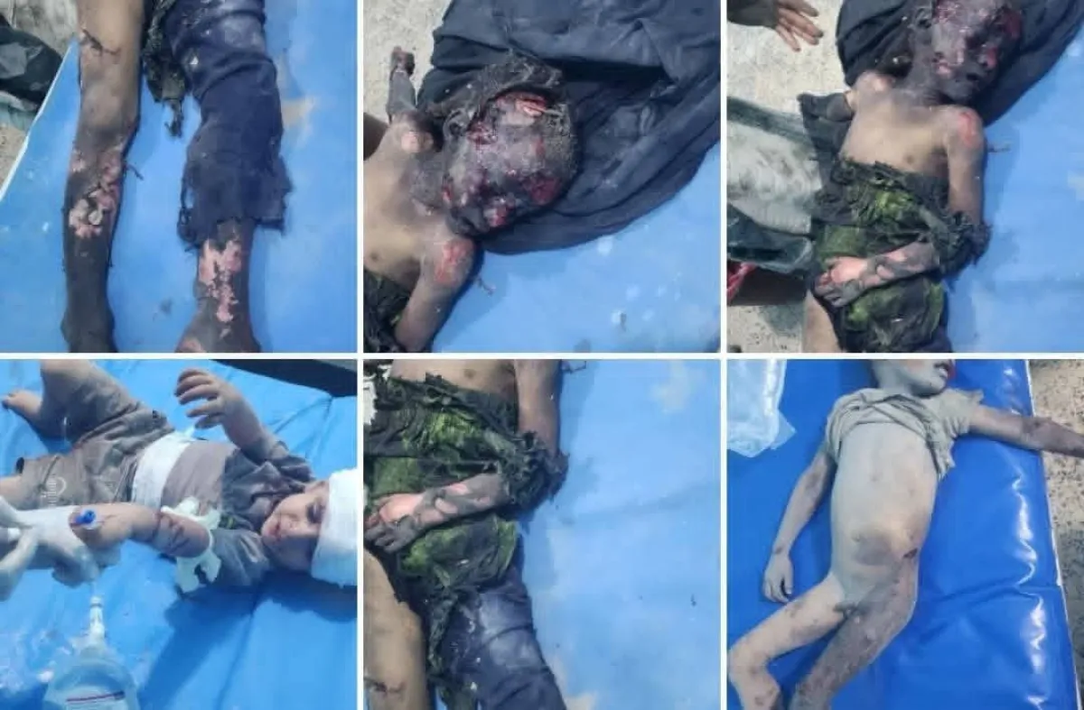 حين تنهار المليشيا على الجبهات.. الحوثيون يفتحون نيران الانتقام على الأطفال والنازحين