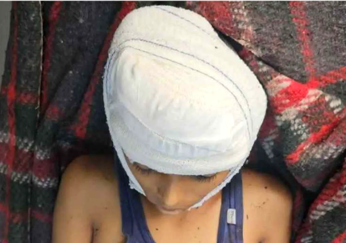 الأمم المتحدة: 176 مدنيًا بين قتيل وجريح في اليمن منذ أغسطس