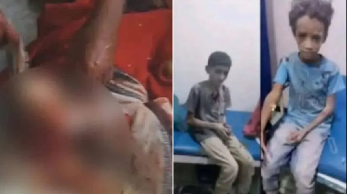 قتلى وجرحى مدنيون في قصف حوثي على تعز ومستشفى يتعرض لأضرار