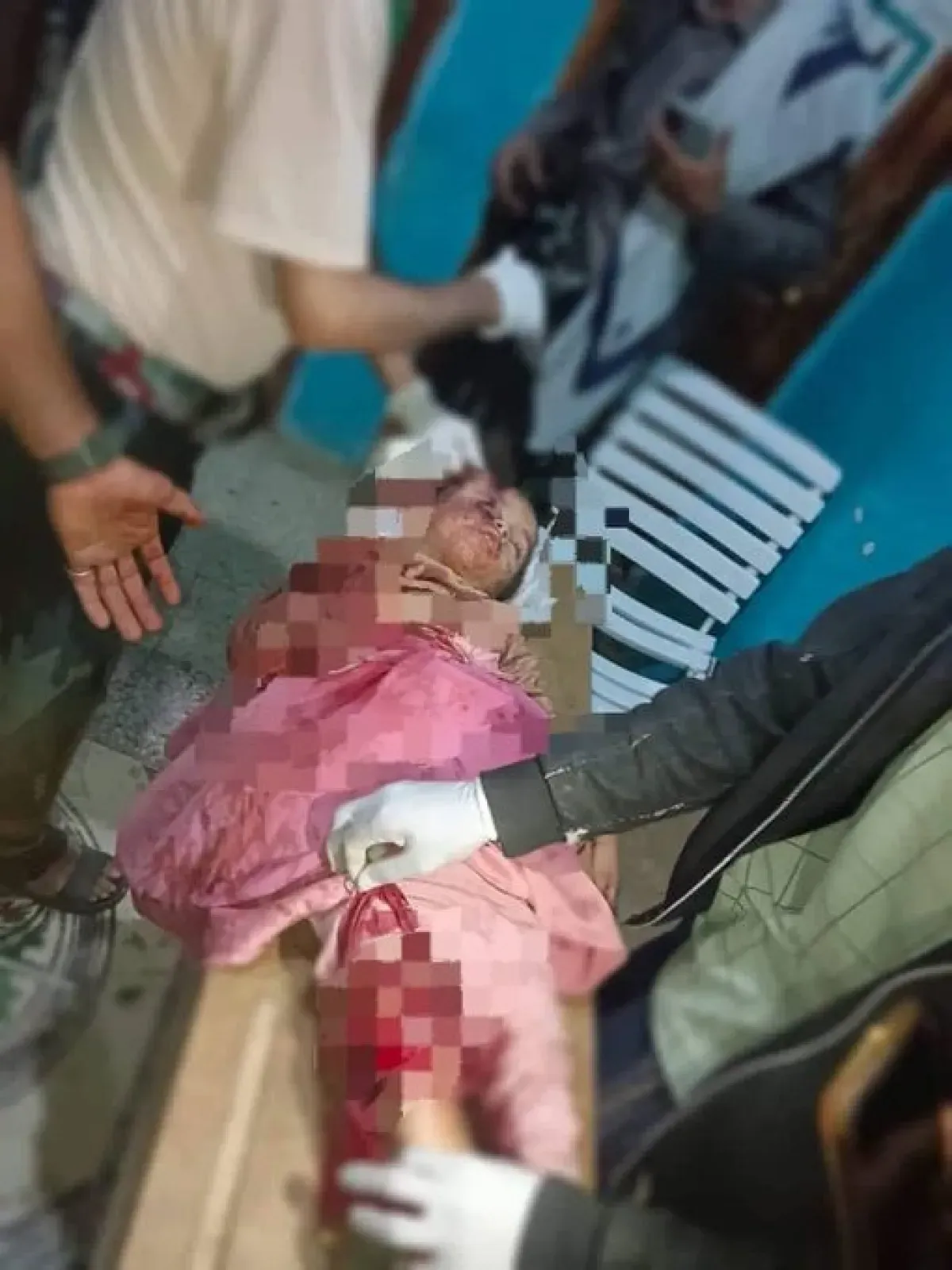 مليشيا الحوثي تستهدف المدنيين في تعز: طفلة تصاب وشاب يستشهد
