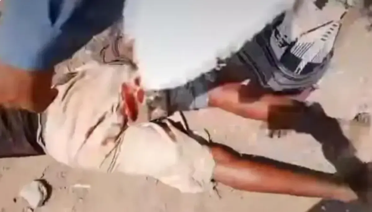 الحديدة.. قيادي حوثي يصيب مواطناً بثلاث رصاصات خلال اعتداء على أراضٍ خاصة